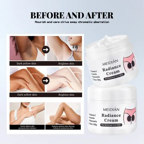MEIDIAN Radiance Cream Body Whitening Cream For Dark Spots Melanin Removal Brightening Body Lotion For Knees Armpits Skin Care