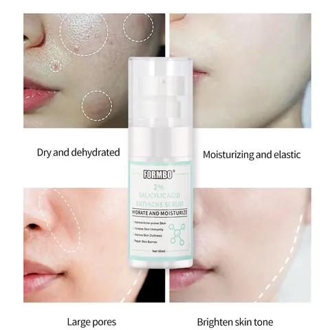 FORMBO Sérum Facial Niacinamida Retinol Ácido Salicílico Ácido Tranexámico 377 Hidratante Iluminador Anti Edad Cuidado de la Piel