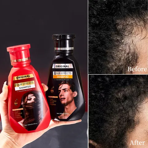 Champú de Aromaterapia 2 en 1 FORMBO Extracto de Jengibre Engrosamiento del Cabello Limpieza Profunda Control de Grasa Fragancia para Hombres y Mujeres