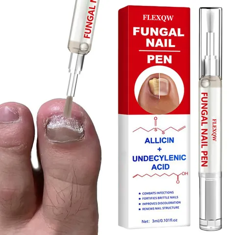 Anti-Fungal Nail Treatment Pen with Allicin and Undecylenic Acid Liquid Repairs Brittle Nails Discoloration Care Tool