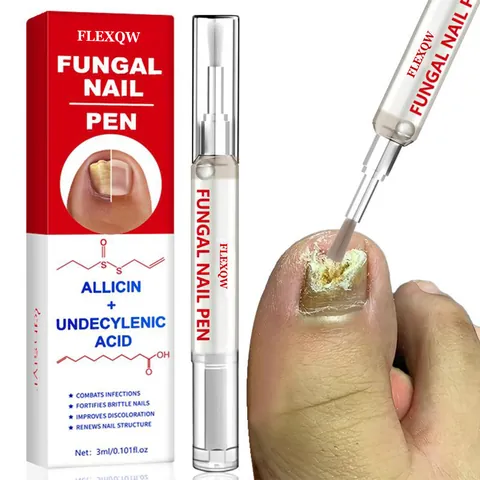 Anti-Fungal Nail Treatment Pen with Allicin and Undecylenic Acid Liquid Repairs Brittle Nails Discoloration Care Tool