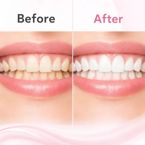 Fluoride Free Toothpaste Serum Micro Apatite Essence Enamel Strength Teeth Whitening Serum Gum Harmony Oral Care Repair