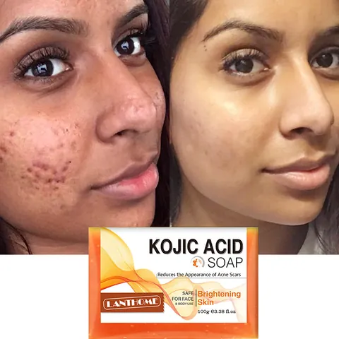 Lanthome Kojic Acid Soap Brightening Skincare Soap Organic Vegan Vitamin E Cleansing Bar For Face Body Acne Scars LBQ8707