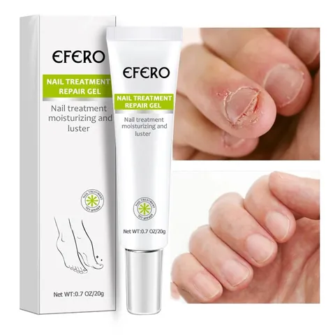 Crema Gel per la Riparazione del Trattamento delle Unghie per le Infezioni Fungine Lozione Idratante Rinforzante Mani Piedi