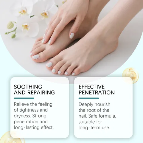 Laniska Olio per il Sollievo della Paronichia Essenza Nutriente per la Cura delle Unghie Siero Riparatore Lenitivo Con Olio di Tea Tree