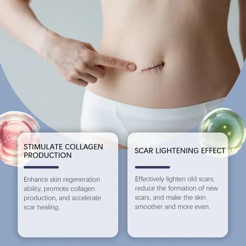 Professional Silicone Scar Cream 55g For Surgical C-Section Acne Scars Skin Care Repair Treatment Deep Moisturizing Gentle Formula