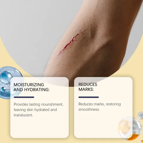 Laniska Keloid Bump Fade Gel Scar Repair Treatment Moisturizing Soothing Skin Care Gel For Piercing Tattoo Body Scars