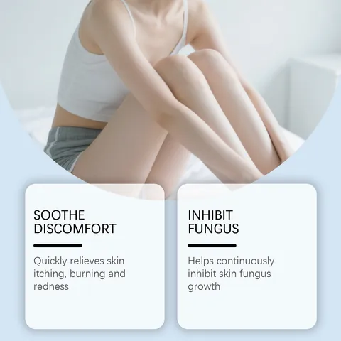 South Moon Antifungal Soothing Cream Moisturizing Skin Care Cream For Body Itch Relief Redness Soothing Gentle Ingredients