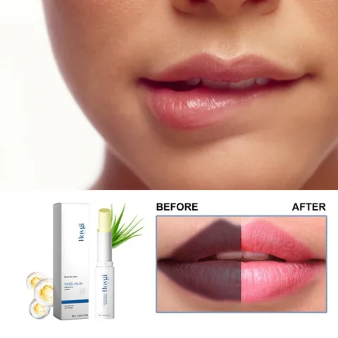Hoygi Hydraterende Lippenbalsam Lippenverzorging om Lippenlijnen te Verminderen Droogheid Herstel Aloë Vera Vaseline