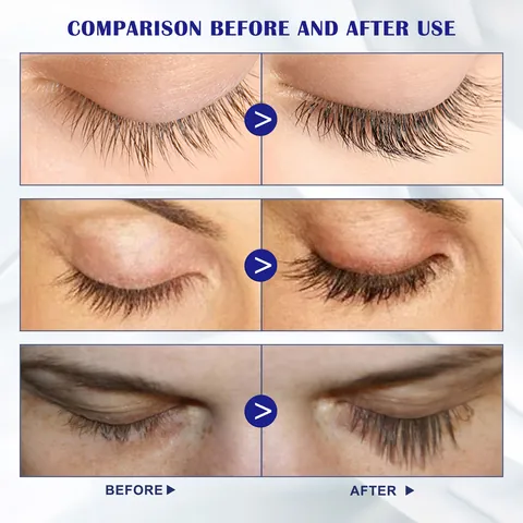 EELHOE Wimpern Vitalisierer Natürliche Längere Dickere Lockige Wimpern Wachstum Serum Nährende Flüssigkeit Lash Enhancer