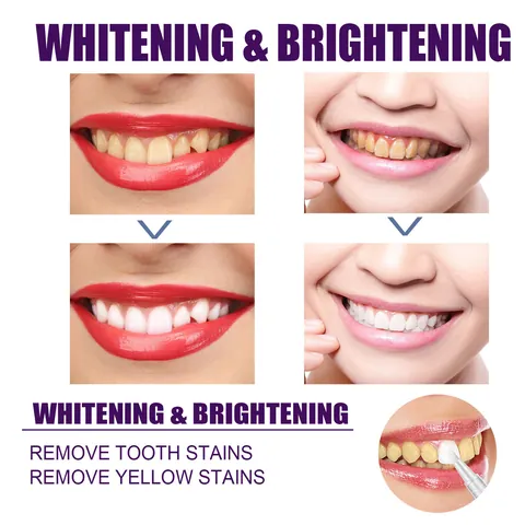 EELHOE V34 Purple Color Corrector Teeth Whitening Pen for Stain Removal and Brightening Portable Oral Cleaning Gel Pen