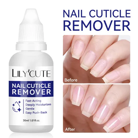 Professional Nail Cuticle Remover Liquid Fast Acting Exfoliating Softener For Manicure Dead Skin Moisturizing Finger Edge Care
