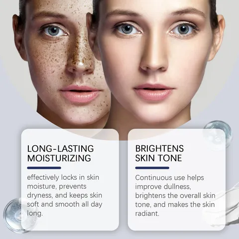 Skin Genesis Spot Whitening Face Cream And Moisturizing Lotion Facial Skincare Anti Aging Brightening Treatment