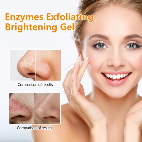 Hoygi Facial Exfoliating Gel Gentle Peeling Gel Deep Cleaning Blackhead Removal Pore Shrinking Brightening Skincare