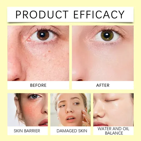 Honey Bee Venom Face Essence Emulsion Moisturizing Hydrating Nourishing Anti Aging Facial Skin Care Lotion