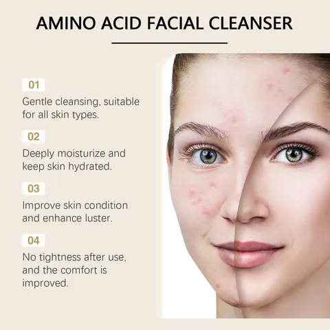 Detergente Viso agli Aminoacidi Pulizia Profonda Delicata Affinamento dei Pori Skincare