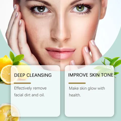 Detergente Viso Anti-Acne Pulizia Delicata dei Pori Pulizia Profonda Idratante Rinfrescante Cura della Pelle