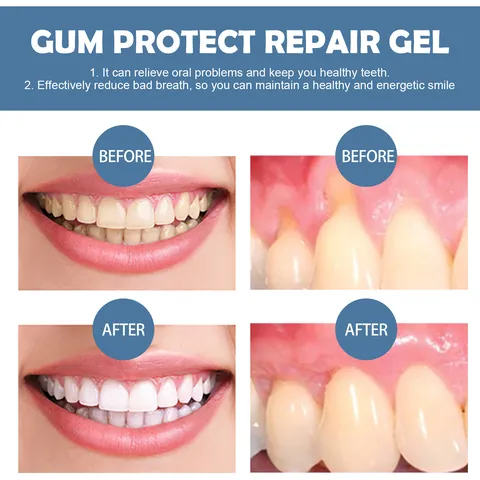 Gel de Réparation des Gencives EELHOE Soins Bucco-Dentaires Nettoyage en Profondeur Élimination des Taches Dentaires Haleine Fraîche Gel de Traitement Dentaire