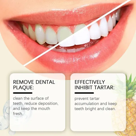 ORALHOE Pineapple Flavor Anti Cavity Fluoride Toothpaste Whitening Fresh Breath Daily Oral Care Cleaning Tooth Paste