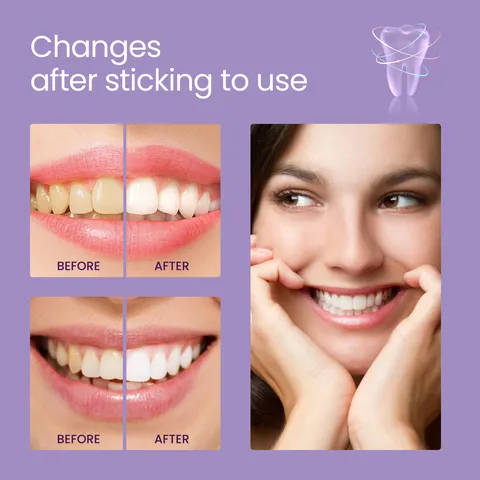 Purple Teeth Whitening Liquid Color Corrector Enamel Care Oral Hygiene Cleaning Serum Fresh Breath Dental Tool