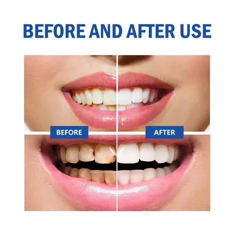 Teeth Whitening Pen Gum Care Gel Deep Cleaning Stain Removal Oral Hygiene Fresh Breath Portable Teeth Care Tool