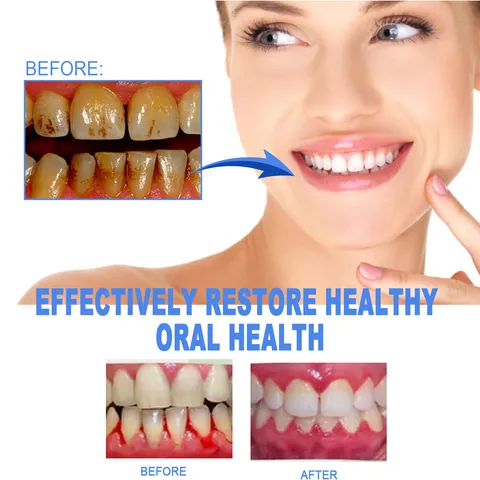 Portable Teeth Care Gel Pen Gentle Cleaning Tooth Stain Removal Oral Hygiene Whitening Pen Home Dental Care Tool