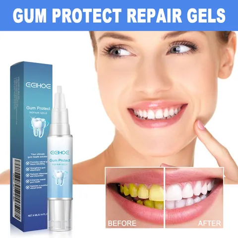 Portable Teeth Care Gel Pen Gentle Cleaning Tooth Stain Removal Oral Hygiene Whitening Pen Home Dental Care Tool
