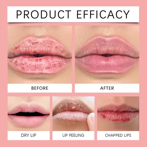 Hydrating Lip Mask Moisturizing Lip Care Treatment Nourishing Repair Dry Lips Fruity Lip Balm Jar Skincare