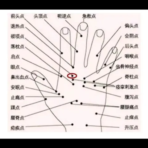 Clip de Masaje de Puntos de Acupuntura de Acero Inoxidable Herramienta de Relajación de Acupresión para Manos Pies Brazos Masajeador Portátil