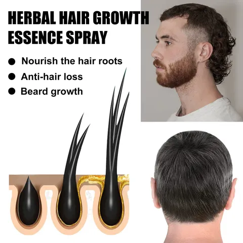 Herbal Hair Growth Essence Spray With Scalp Micro Needle Roller Nourishing Anti Hair Loss Scalp Care Liquid Set