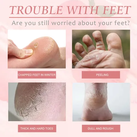 Peach Foot Peel Mask Exfoliating Moisturizing Nourishing Repairing Dry Cracked Heels Dead Skin Removal Foot Care Treatment