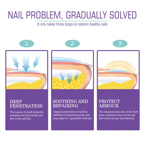 Jaysuing Nail Fungus Spray Foot and Hand Care Anti Fungal Treatment Repair Liquid Soothing Cooling Formula