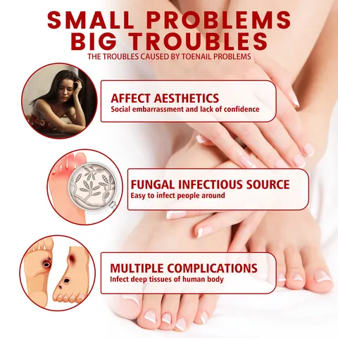 Nail Repair Essential Oil Nourishing Softening Nail Care Treatment Liquid Plant Extract Nail Treatment Oil For Finger