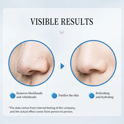 Flacone Contagocce in Vetro Liquido di Esportazione per Punti Neri Essenza Viso Restringente per Pori Trattamento per la Cura della Pelle