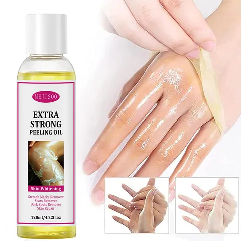 Extra Strong Peeling Oil Exfoliating Body Lotion Deep Cleansing Brightening Skin Care Body Oil For Daily Body Care
