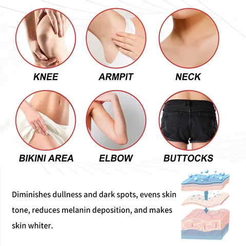 Whitening Body Cream Moisturizing Repair Dark Spot Corrector For Underarms Skin Brightening Body Lotion