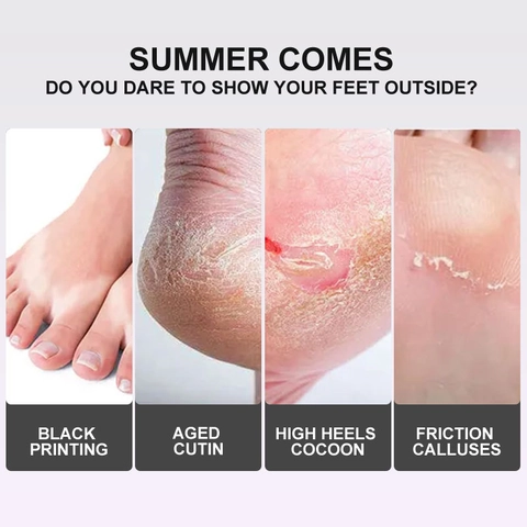 Lavendel Vitamin C Peeling Fußmaske Zur Entfernung Von Abgestorbener Haut Und Hornhaut Macht Die Fersen Weich Feuchtigkeitsspendend Home Spa Hautpflege