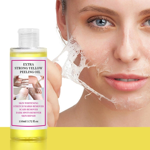 Olio Peeling Giallo Extra Forte Per Sbiancamento Pelle Rimozione Macchie Scure Riparazione Cicatrici Soluzione Peeling Corpo Viso