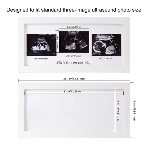 Sonogramm Bilderrahmen MDF Holz Plexiglas Schwangerschaft Ultraschall Foto Gedenken Kinderzimmer Weiß