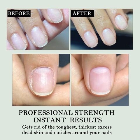 Professional Nail Cuticle Softener Aloe Vera Repair Liquid Moisturizing Treatment For Manicure Care And Healthy Fingertips