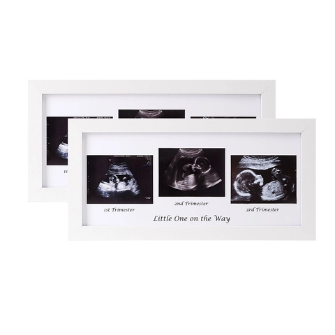Cornice Per Foto Ecografia Legno MDF Plexiglass Gravidanza Ricordo Decorazione Stanza Neonato Bianco