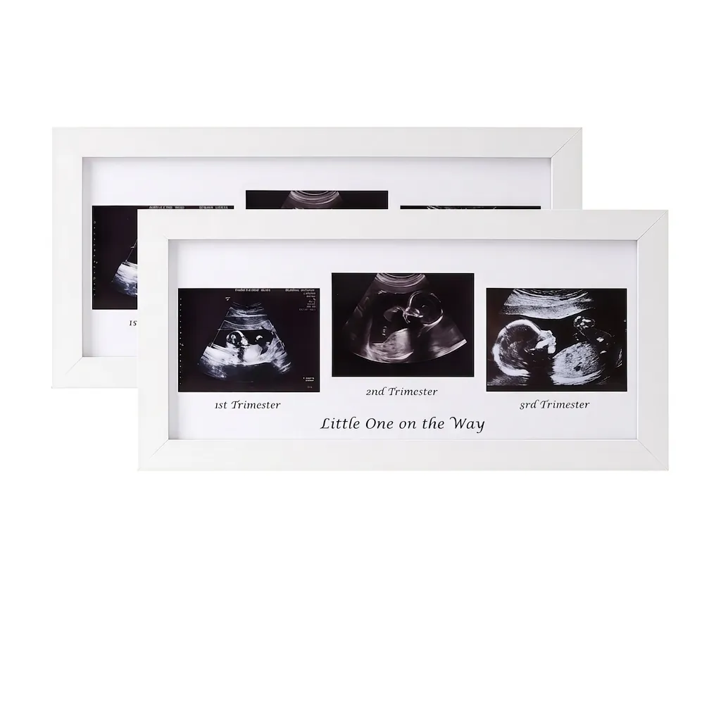 Sonogram Picture Frame MDF Wood Plexiglass Pregnancy Ultrasound Photo Memorial Nursery Wall Decor White