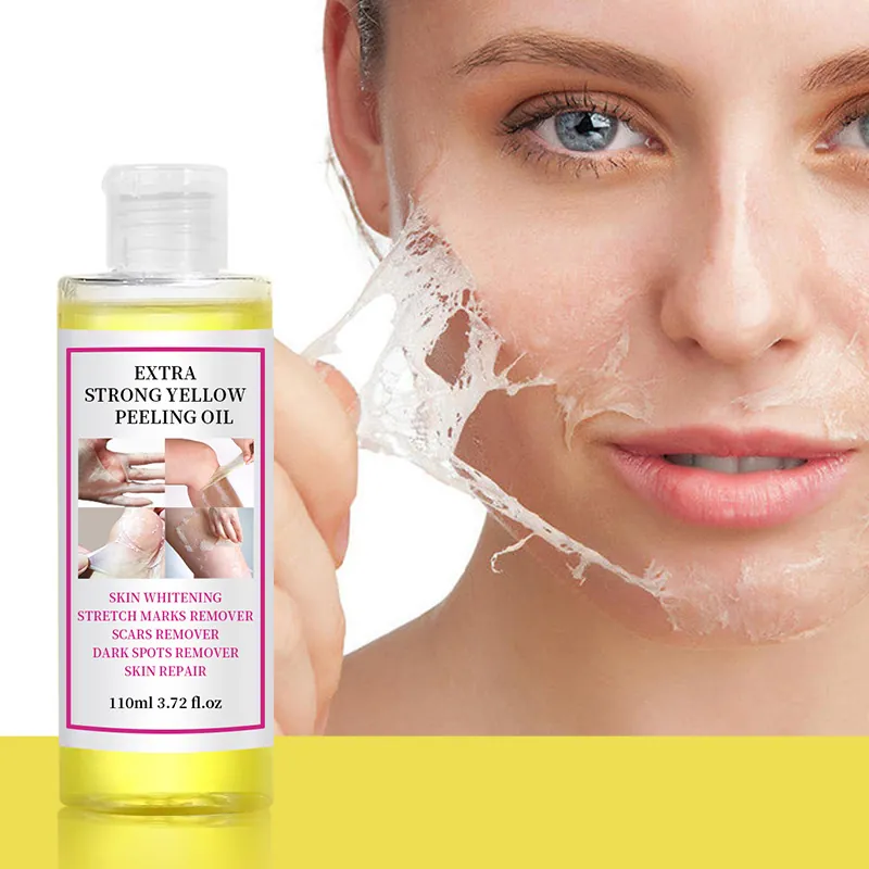 Extra Strong Yellow Peeling Oil For Skin Whitening Brightening Dark Spots Removal Scars Repair Body Face Peeling Solution